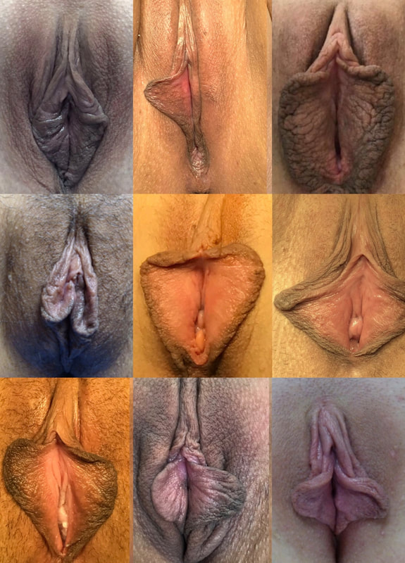 different types of vaginas